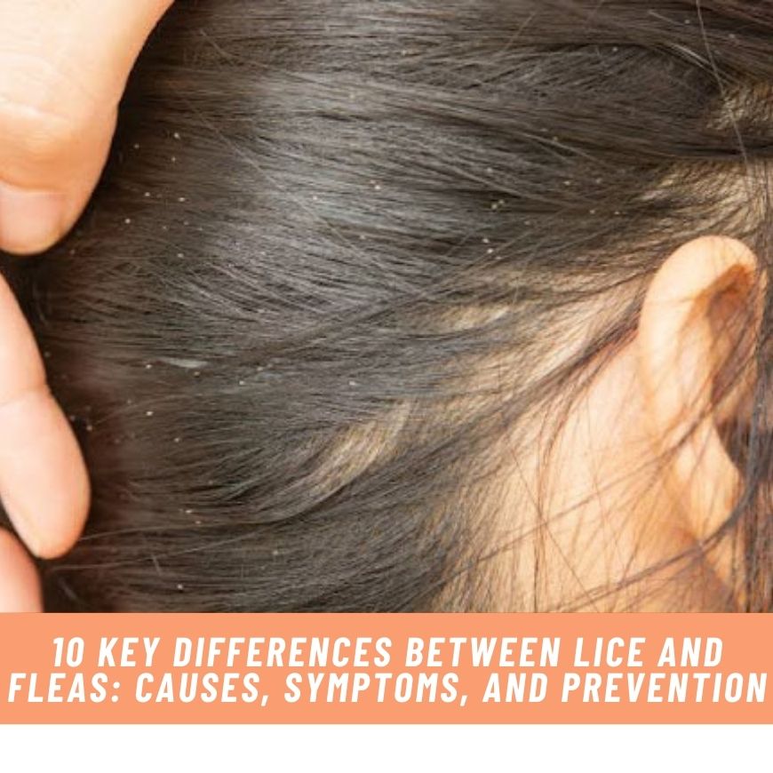 10 Key Differences between Lice and Fleas: Causes, Symptoms, and Prevention