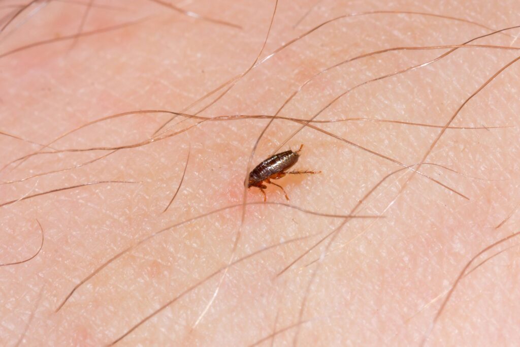 The little insects known as lice and fleas feed on human blood. Still, you can tell them apart in important