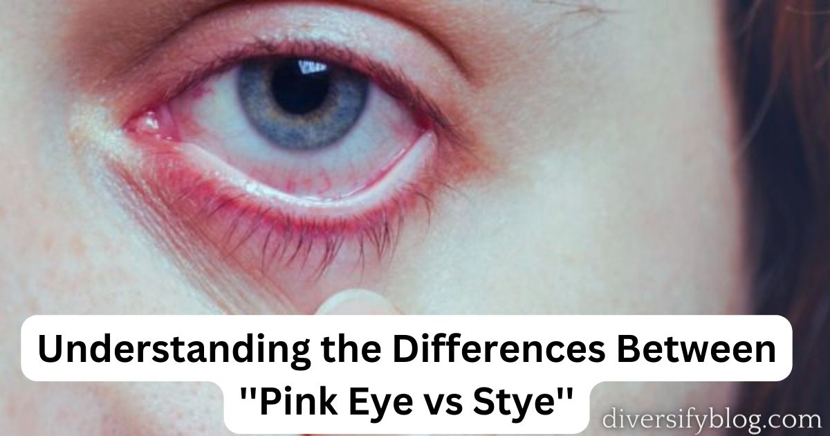 Understanding the Differences Between ”Pink Eye and Stye’.