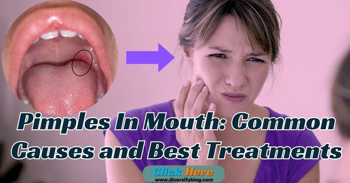 Pimples In Mouth: Common Causes and Best Treatments